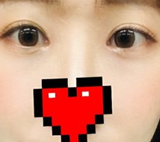 現代美学整形外科は目の名店だと認めます bb