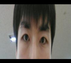 恥ずかしいですが、正直な男性二重手術レビュー..