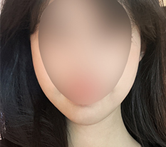 The facial line change is great~