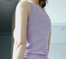 脂肪分解注射でダイエット停滞期を克服