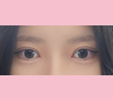 くっきりラインで完結