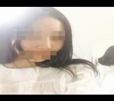 悩んだ末に受けた鼻整形のレビュー