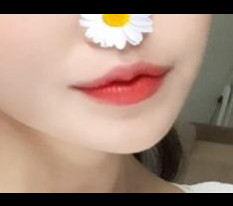 口角整形をしました♡