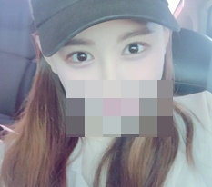 The emotion of double-eyelid surgery T_T
