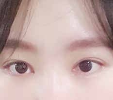 ぼんやりした印象がはっきりしました