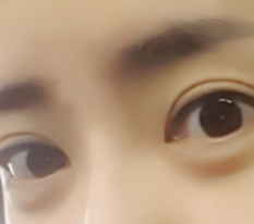 I am completely satisfied with my eye surgery!
