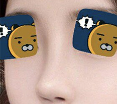 現代美学整形外科で鼻やりました!! 本当にうまくいった感じ!!
