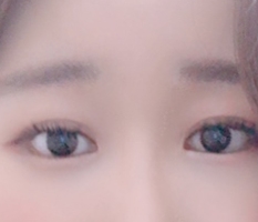 ♡目元切開3種セット♡