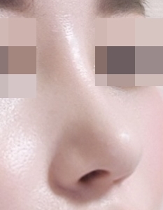 私の鼻、すごく綺麗になりました~,~