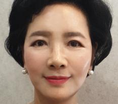 一生苦労ばかりしてきた母にフェイスリフトを受けさせたら、とても幸せそうです