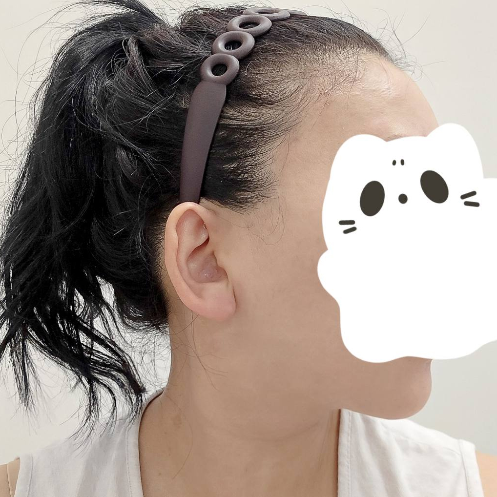 顔＋二重あご脂肪吸引のレジェンド 顔脂肪吸引・あご脂肪吸引を調べている方は必見