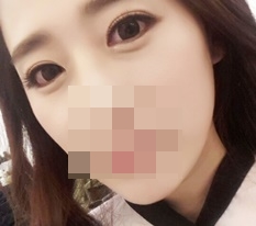 Highly recommend 現代美学整形外科 eye-shape correction!~♥