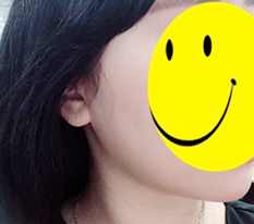 From one-two-three-four chins to one chin