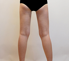 Lower-body line improved well
