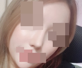 鼻手術レビュー