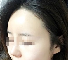 自分のものじゃないようで自分のものみたいな額 : )