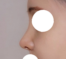Please look at my nose line