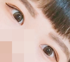 やった >_< 二重まぶた！