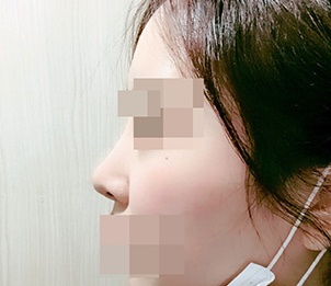 再手術は成功しました '< '♥