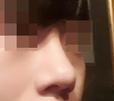 男性の鼻も完璧に仕上げてくださいました。