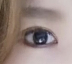 やっぱり現代美学整形外科は現代美学整形外科