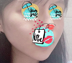 早く腫れが引いてほしい~~~~~