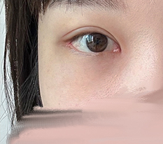 パンダ顔から脱出 笑