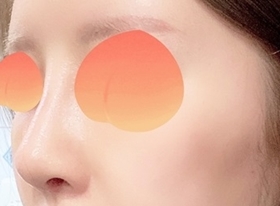 現代美学整形外科 is great for noses hehe