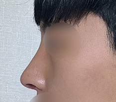 前後がはっきりしています