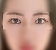 左右差のある目がそろいましたㅋㅋ
