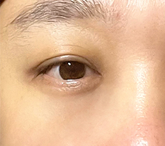 自分の年齢を取り戻しましたㅋㅋ