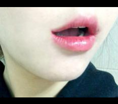 口角整形レビューを載せます~~!