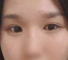 Escaped from tiny narrow eyes!! Thank you, Director Hwang-ho!!