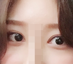 やっぱり目整形が上手なのは認める *=_=*!!!
