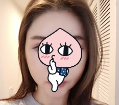 ストレスだった頬骨を現代美学整形外科で解決しました^.^