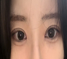 ものすごく大きな目になりました！