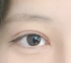 二重整形をして新しい人生ですㅠㅠ