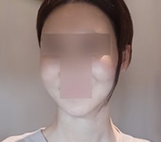 顔のラインが戻ってきました ㅎㅎ