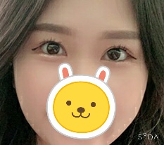 When it comes to eyes, 現代美学整形外科 really seems right haha