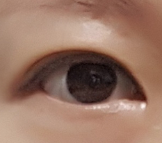 眼瞼下垂矯正と二重手術4か月目~^^