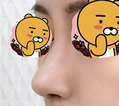 鼻の修正手術の満足度がこんなに高いとは思いませんでしたよ笑