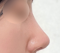 顔に立体感が出ました