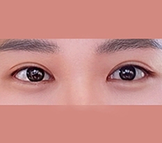 A go-to place for eye revision