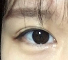 院長先生のおかげで私の目がきれいになりました