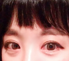 切開、本当に最高