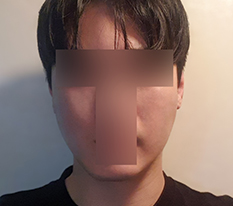 効果が良かったです