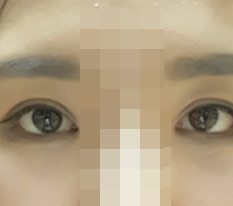 見違えるほど変わった目