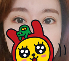 Eye surgery at my age... but I am completely satisfied ^^