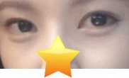 左右非対称から解放されました ㅋㅋ