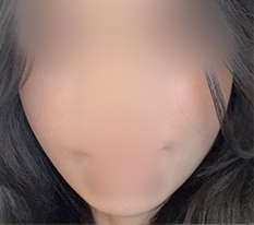 一度で若返り